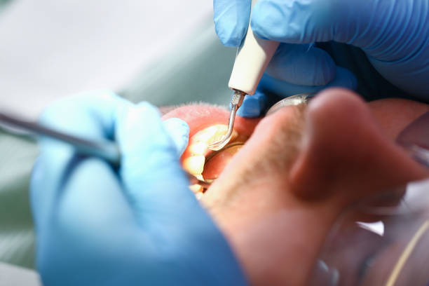 Best Emergency Broken Tooth Repair in Stateburg, SC